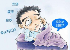 包皮龟头炎的类型和表现